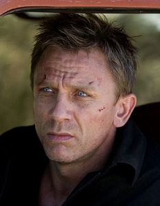  Даниъл Крейг

Филм: James Bond: Quantum of Solace (2008)   

Къде: Лице 
  
Как: Джеймс Бонд може и да се разминава без драскотини след хиляди бойни сцени на екранa, но в реалността ситуацията е малко по-различна. В това може да ви увери и британецът Даниел Крейг, който наскоро дори се подложи на пластична операция, за да премахне белези от лицето си, получени на снимките на The Quantim of Solace. Инцидентът станал, след като негов колега неволно го ритнал, в резултат на което се окичил с осем шева, а на всичкото отгоре успял да нарани и един от пръстите на ръката си...

