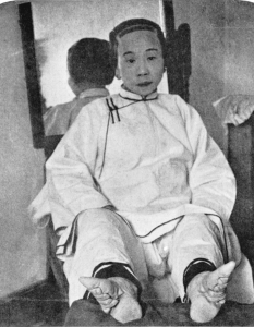 3. Връзване на краката – Китай
Тази традиция е наистина ужасяваща – младите момичета трябва да преживеят нечовешка болка. Краката се чупят, след което се покриват плътно с превръзки. Целта на този обичай е краката на момичетата да останат достатъчно дребни и да не порастват повече от необходимото, в резултат на което се деформират неузнаваемо. 
През 1949 година обаче обичаят е забранен от комунистическата партия и днес вече не се изпълнява. 