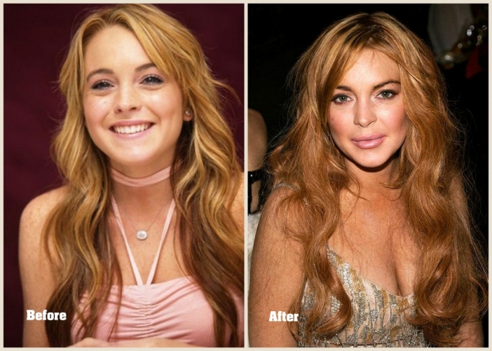 Линдзи Лоън (Lindsay Lohan)
Някога рижавата и чаровна вече изглежда доста по-различно.
