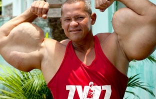 Смъртоносен бицепс - бразилец рискува живота си в името на своите мускули (Видео)