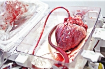 Създадоха първото 3D-принтирано сърце с човешка тъкан (видео)