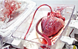 Създадоха първото 3D-принтирано сърце с човешка тъкан (видео)