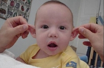 От мрежата: залепихме ушите на бебето ни и сега не можем да ги отлепим. Помощ!