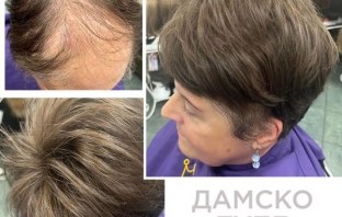 Тупета за жени и мъже от Магама – когато животът започва отново Тупета за жени и мъже от Магама – когато животът започва отново