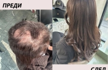 Тотална трансформация след химиотерапия в салон Магама