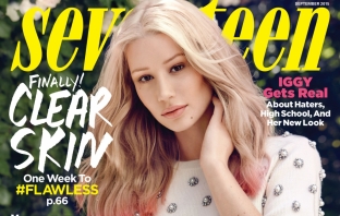 Iggy Azalea открито за пластичните си операции пред Seventeen (Снимки)