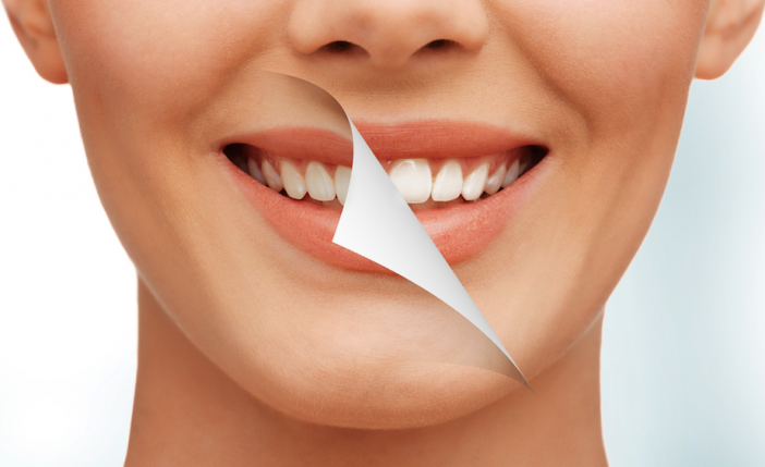 10 начина да избелим зъбите си с натурални продукти