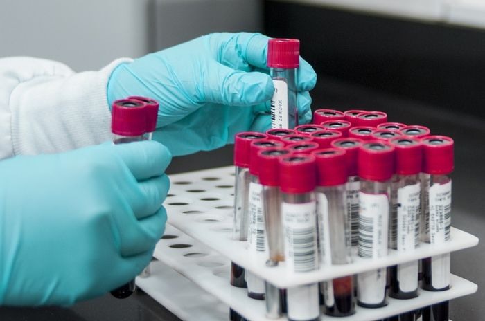 медицински проби